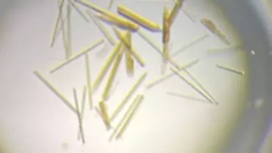 Photo of protein crystals